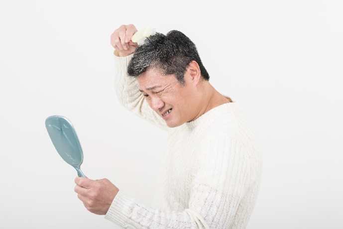 usu 074 01 薄毛が気になるなら……、毛髪診断を受けてみよう！その?