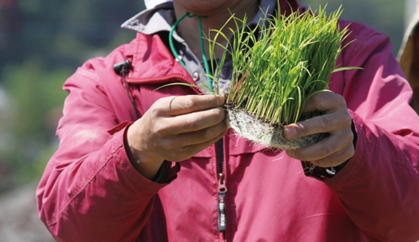 usu 088 03 自毛植毛は田植えっぽい？自毛植毛の手順【その①】