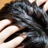 頭皮の皮脂と薄毛は関係あるの？頭皮ケアの必要性を考える