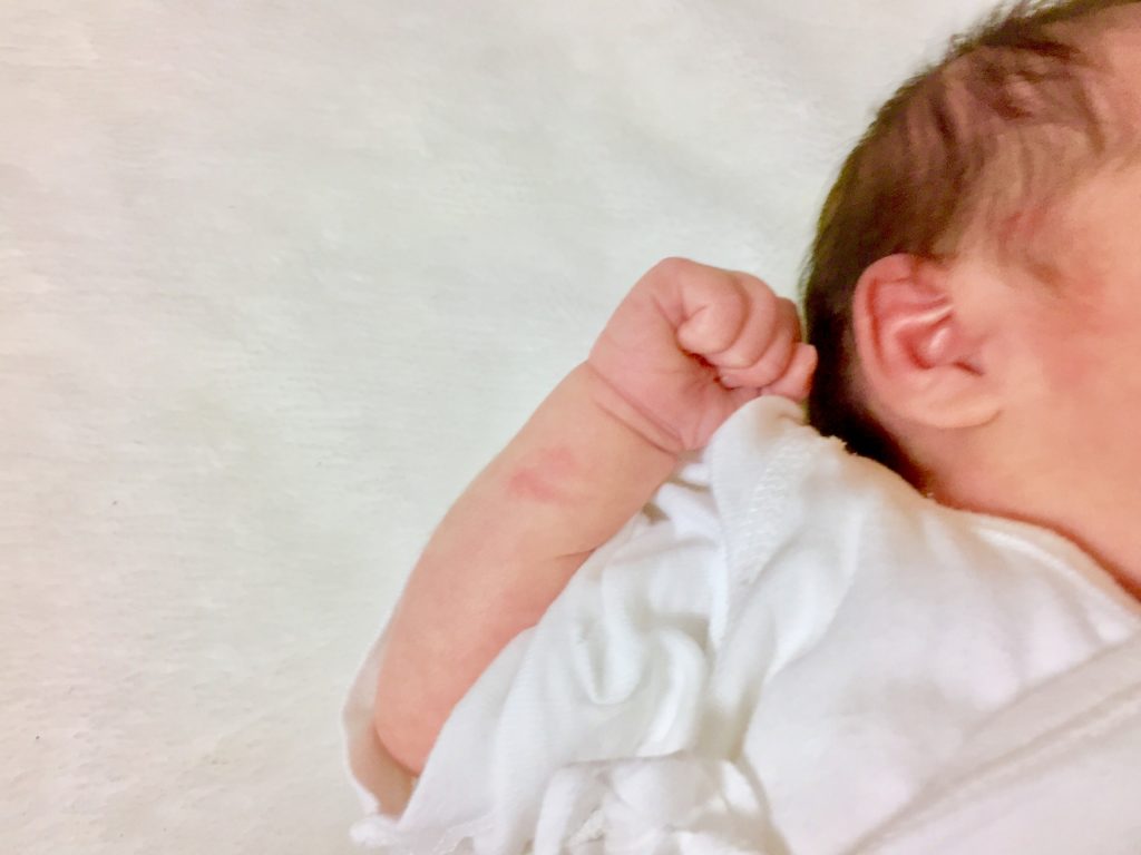 0919151001da15c0490fbb52f79c7647 m 1024x768 新生児にも毛が生えているのは何故？毛包の発生について