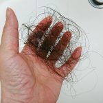 抗ガン剤治療で脱毛するのはどうして？原理を活かすと発毛にも光？