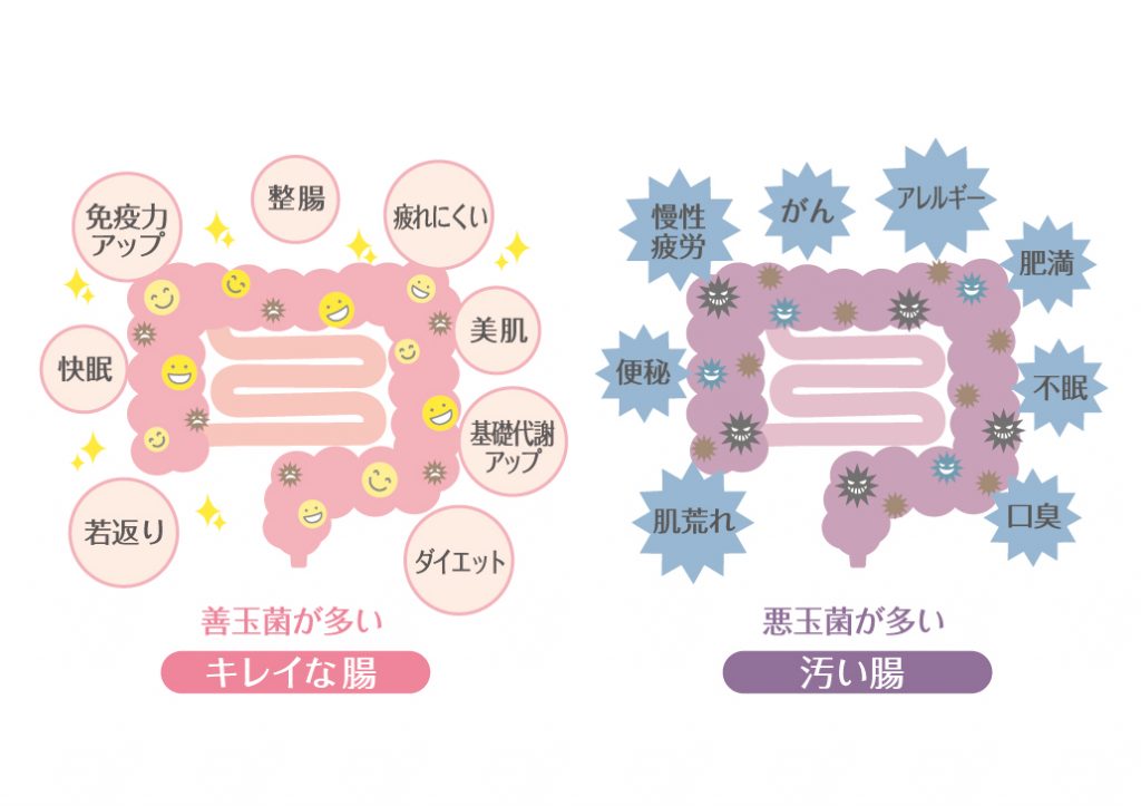1461276 1024x723 腸内のデブ菌とヤセ菌は、肥満だけでなく薄毛もまねくの？