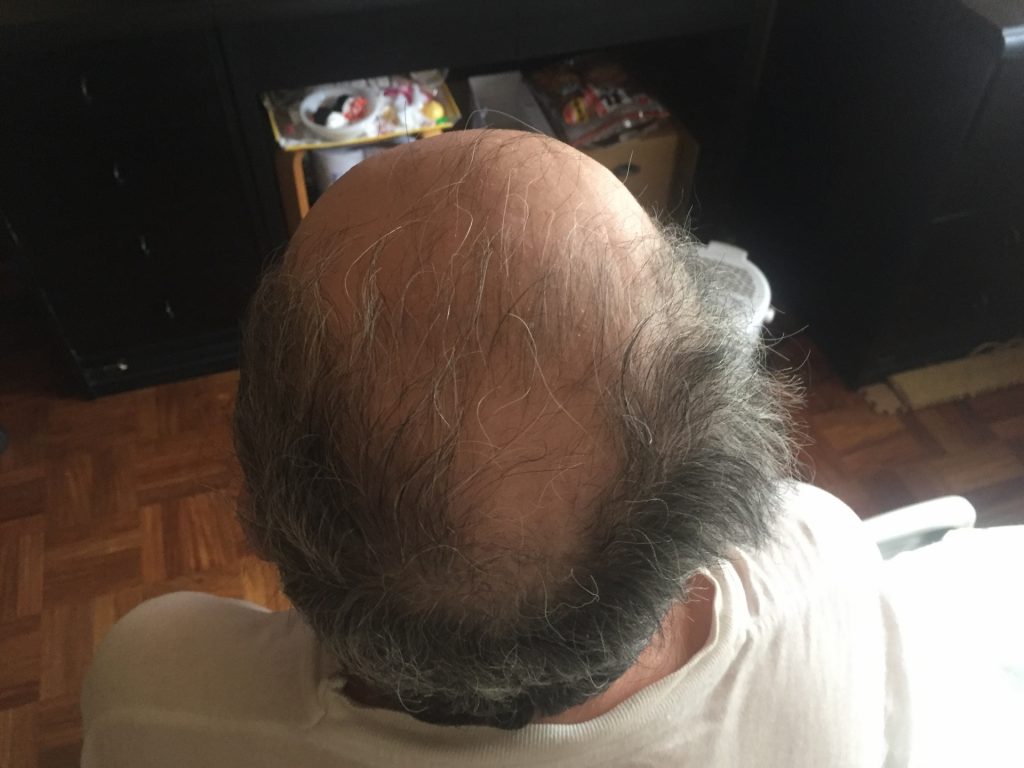 461584 m 1024x768 短い抜け毛が多くなるのは、男性型脱毛症の可能性アリ？