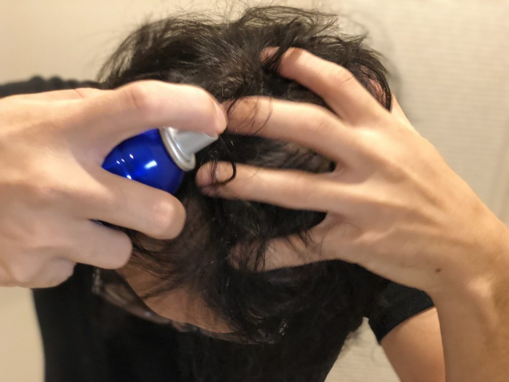 1995520 m 1024x768 【薄毛の体験談】公務員Kさんの場合、最初の気づきは他人からだった