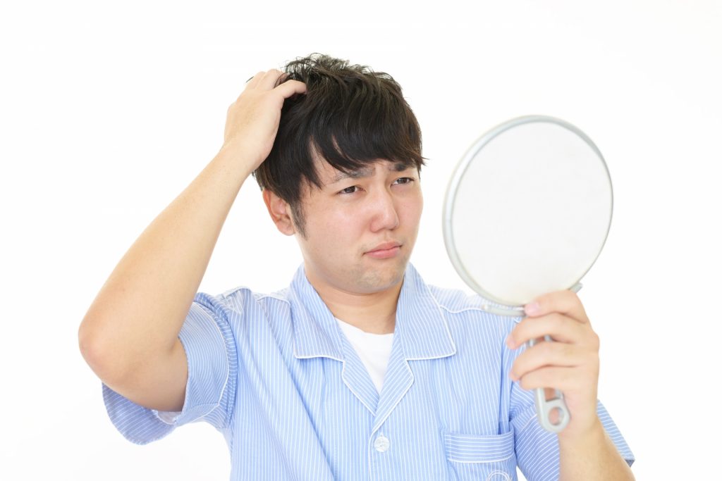 4493789 m 1024x683 「抜け毛が多い」から「ハゲ」を自覚するまでの経緯とは？