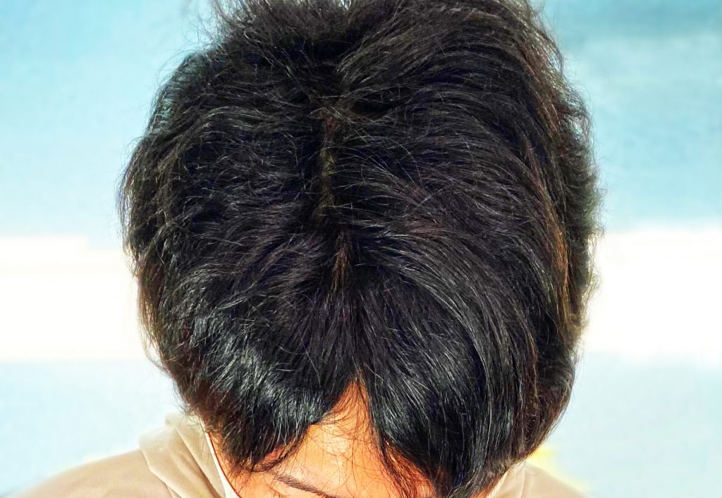 22008742 m 1024x707 カツラを使い始めたら注意してほしいこと?