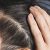 ヘアサイクルがどうなると薄毛になる？しくみと予兆の判断