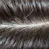 髪の生える位置や方向はどう決められる？皮膚のすごい能力