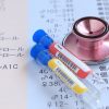 糖尿病と薄毛の関係とは？ある医師の経験談より考えてみよう