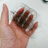 抗ガン剤治療で脱毛するのはどうして？原理を活かすと発毛にも光？