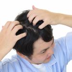 ハゲるには若すぎる？年齢相応のハゲに違いはあるのか
